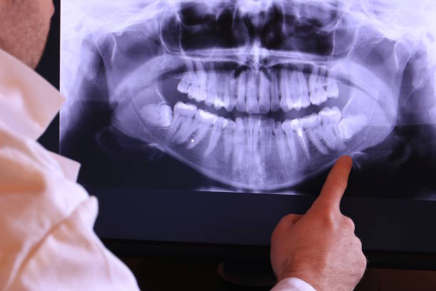 Best Walk-In Emergency Dental Services in Holstein, IA